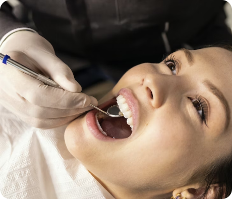 Dental Fillings
